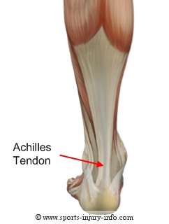 Achilles tendon; Calcaneal Tendon